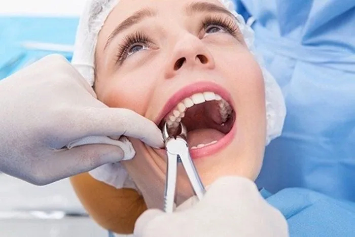 Nhổ răng khôn xong có quan hệ được không?