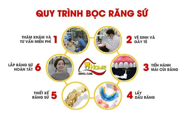Bọc Răng Sứ Liệu Có Đau Không?