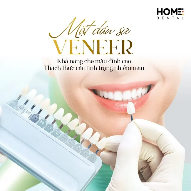 Có nên dán răng sứ veneer không? Có bền không?