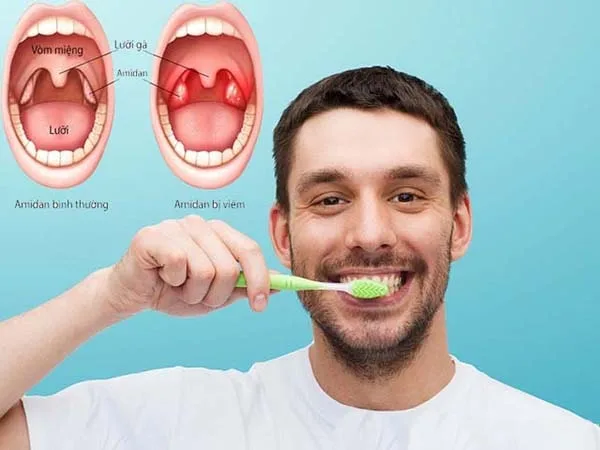 Thực hiện vệ sinh răng miệng sau khi cắt amidan