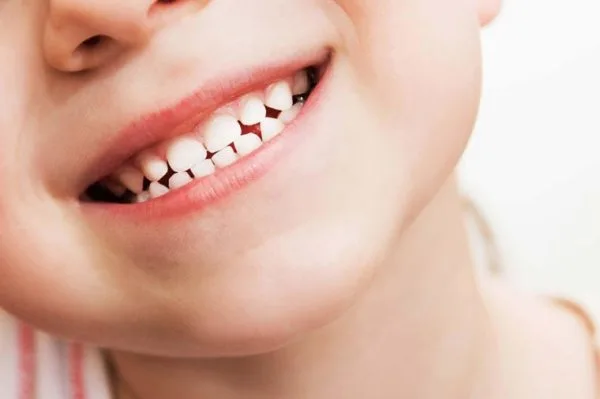 Trẻ 5 Tuổi Mọc Răng Hàm: Mẹ Cần Biết Những Gì Để Đảm Bảo Chăm Sóc Tốt Nhất?