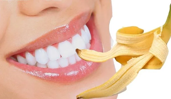 Có thể thực hiện làm trắng răng bằng vỏ chuối được không?