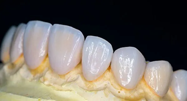 Đặc điểm răng sứ DDBio