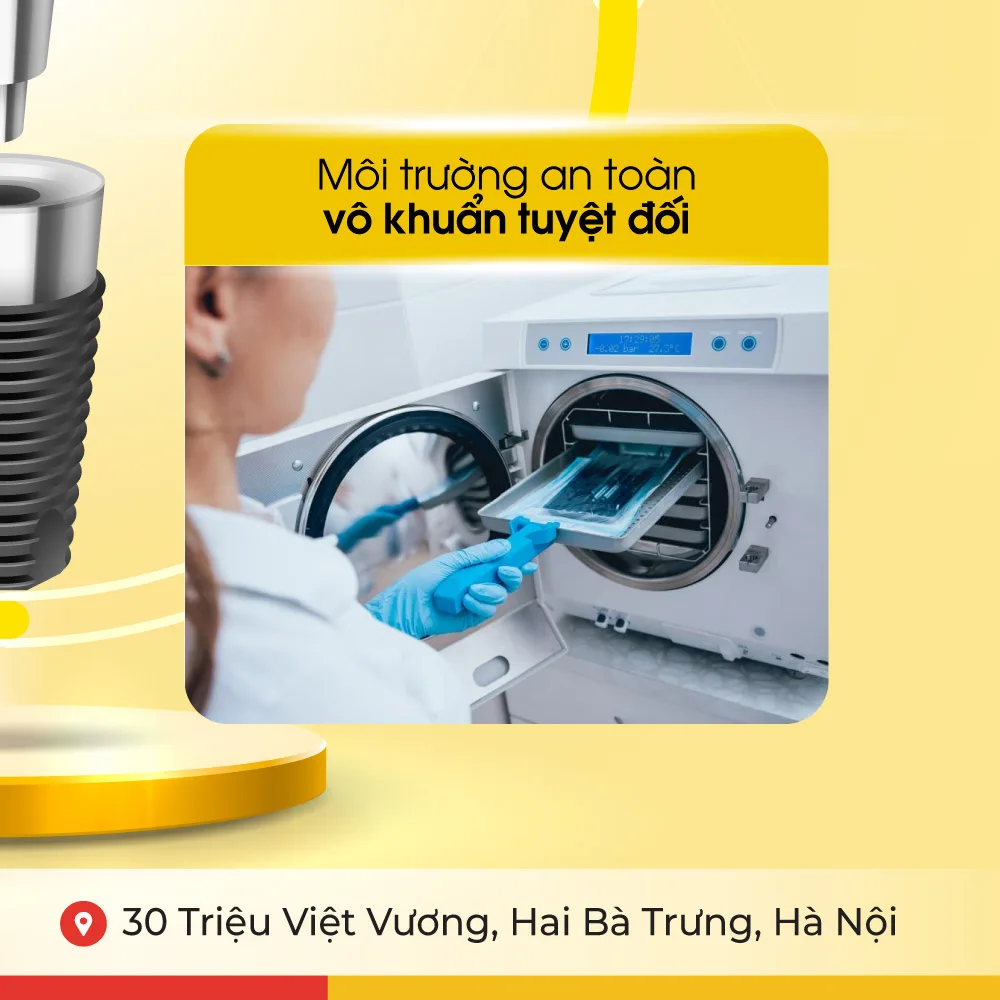 Đặc quyền khi trồng răng implant 4