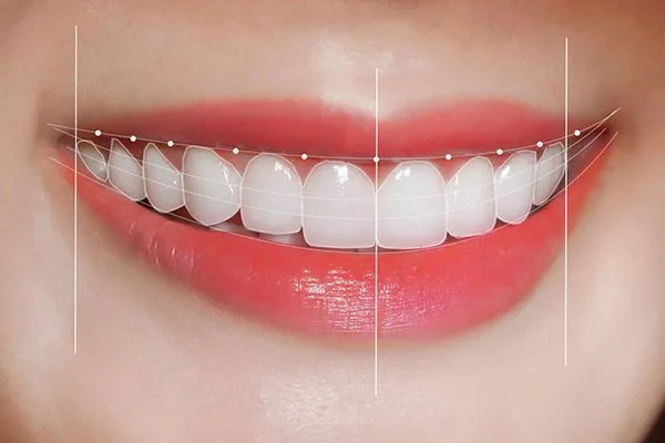 Top 8 dáng răng sứ đẹp phổ biến năm 2024