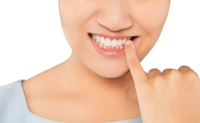 Hướng dẫn loại bỏ thức ăn nhét vào chỗ nhổ răng