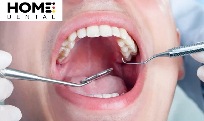 Sưng Lợi Răng Số 7: Nguyên Nhân Và Giải Pháp Khắc Phục