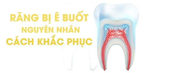 Răng bị ê buốt: Nguyên nhân và cách khắc phục