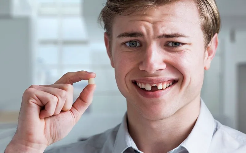 48 Tuổi Bị Rụng Răng Là Do Đâu?