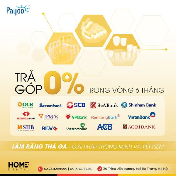 Trồng răng Implant trả góp được không?