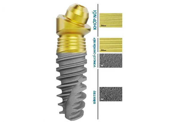 Cấu tạo trụ implant nobel