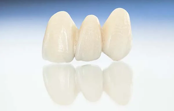 Ưu điểm nổi bật răng sứ nacera