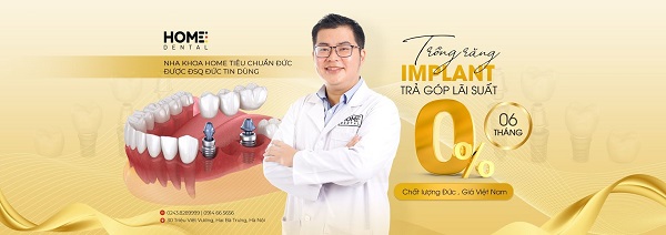 nha khoa cấy ghép implant