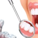 Khả năng tài chính thấp có thể trồng Implant được không?