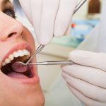 Trồng răng Implant có bền không? Tuổi thọ của răng Implant là bao lâu?