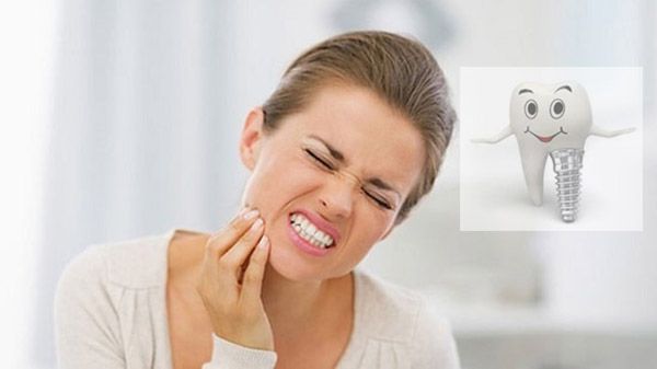 Cách giảm đau sau khi trồng răng implant