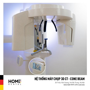 Trồng răng implant an toàn bằng máy chụp phim CT Cone Beam