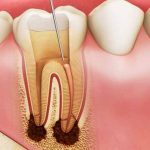 Ý nghĩa tướng số của những người cười hở lợi?