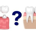 Cấy ghép implant đi máy bay được không?