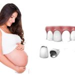 Nên trồng răng implant hay bắc cầu răng sứ