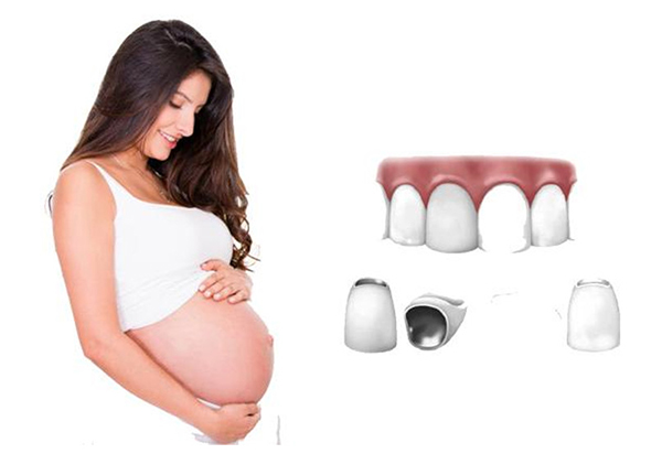 Giải đáp: Phụ nữ có bầu trồng răng implant được không?