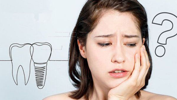 Top 5 lý do cấy ghép implant bị sưng 