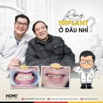 Trồng răng implant hút thuốc lá được không?