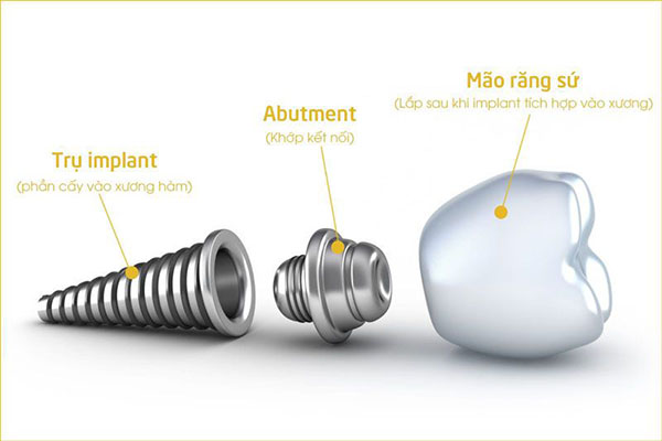 Cấu tạo trụ implant dentium mỹ