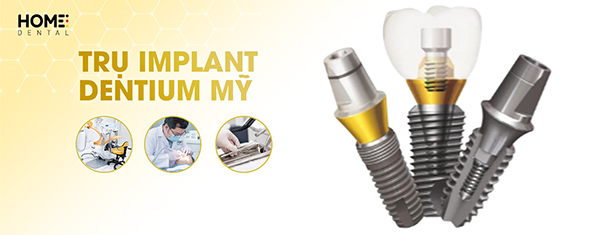 Trụ Implant Dentium Mỹ: Cấu tạo và ưu điểm nổi bật