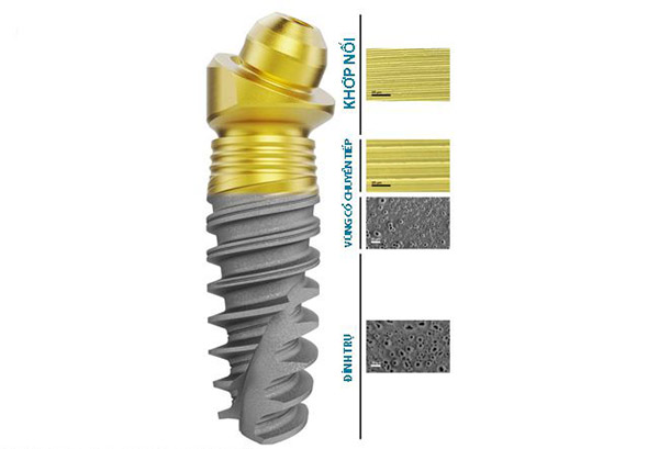 Cấu tạo trụ implant nobel