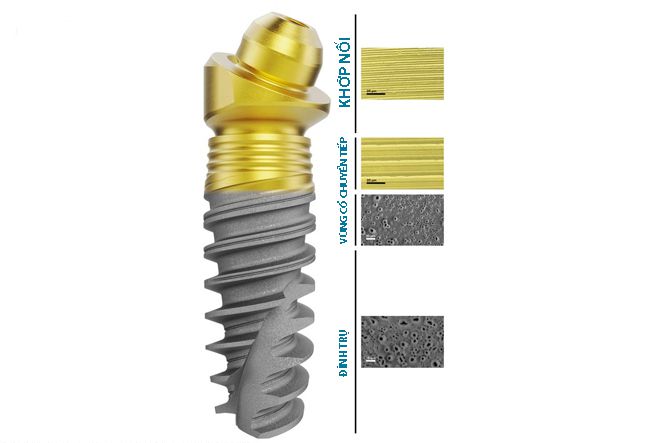 Cấu tạo trụ Implant Nobel 