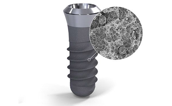 Giá trụ Implant Straumann Thụy Sĩ bao nhiêu?