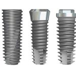 Trụ implant adin: Xuất xứ, cấu tạo và ưu điểm nổi bật