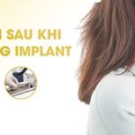 Chườm lạnh sau khi trồng răng implant có giúp giảm sưng không?