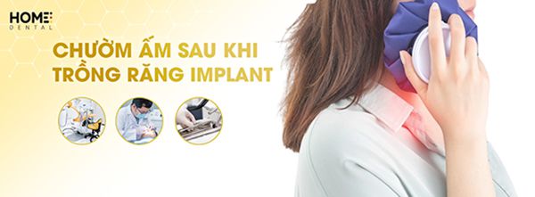 Chườm ấm sau khi trồng răng implant có tác dụng như thế nào?