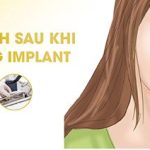 Top 6 đối tượng nào không nên trồng răng implant