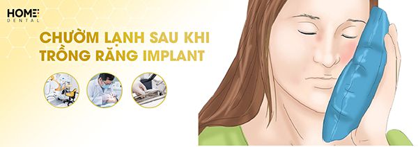 Chườm lạnh sau khi trồng răng implant