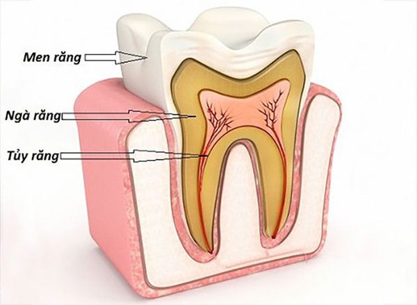 Nguyên nhân răng bị ế buốt