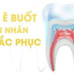 Top 3 trường hợp đau răng không nên ăn thịt gà?