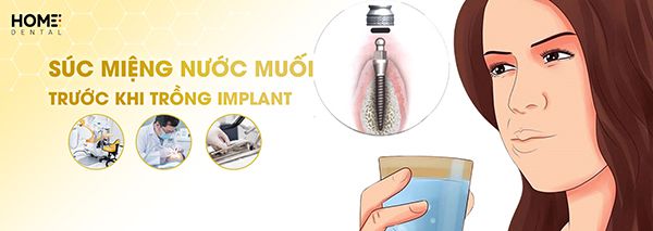 Vì sao không nên súc miệng bằng nước muối sau khi trồng răng implant?