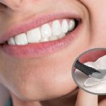 Viêm nha chu cấy ghép implant được không?