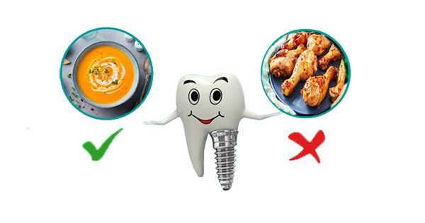 Trồng răng implant có ăn được thịt gà không