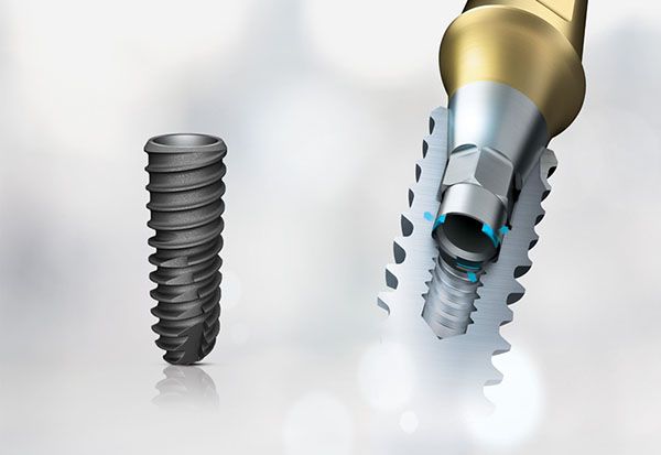 Ưu điểm trụ implant ETK