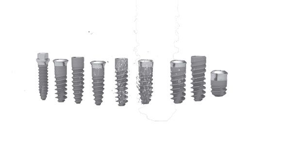 Trụ Implant ICX: Xuất xứ, cấu tạo và ưu điểm nổi bật