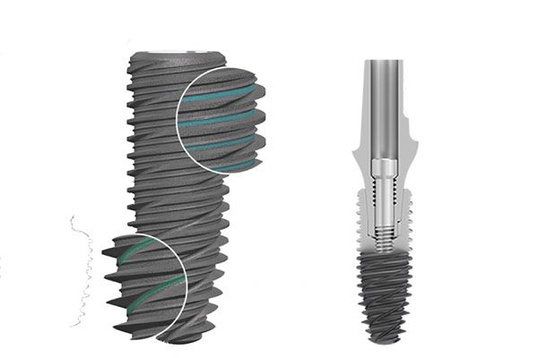 Ưu điểm trụ implant Kontact