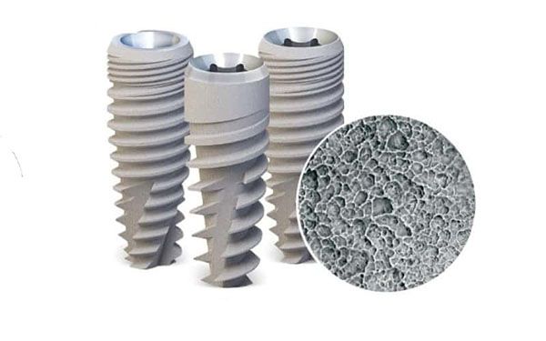 Ưu điểm trụ Implant Paltop