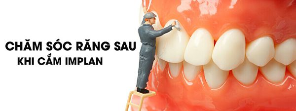 Chăm sóc răng sau khi cắm implant như thế nào?