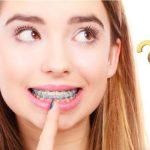 Giải đáp: Cấy ghép implant sau sinh được không?