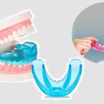 Chăm sóc răng sau khi cắm implant như thế nào?