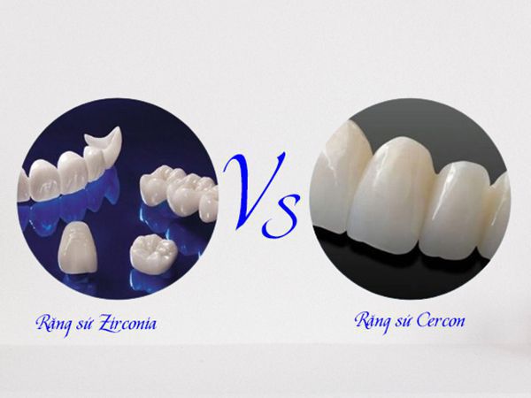 So sánh răng sứ Zirconia và Cercon